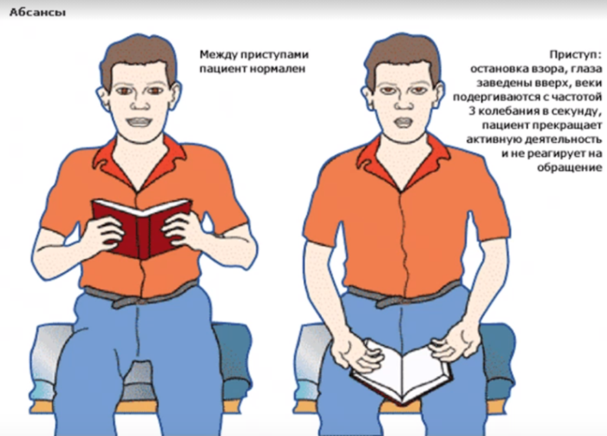 Абсансы