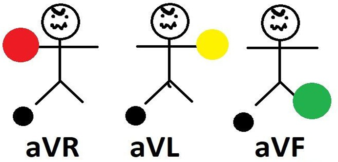 Однополюсные (усиленные) отведения